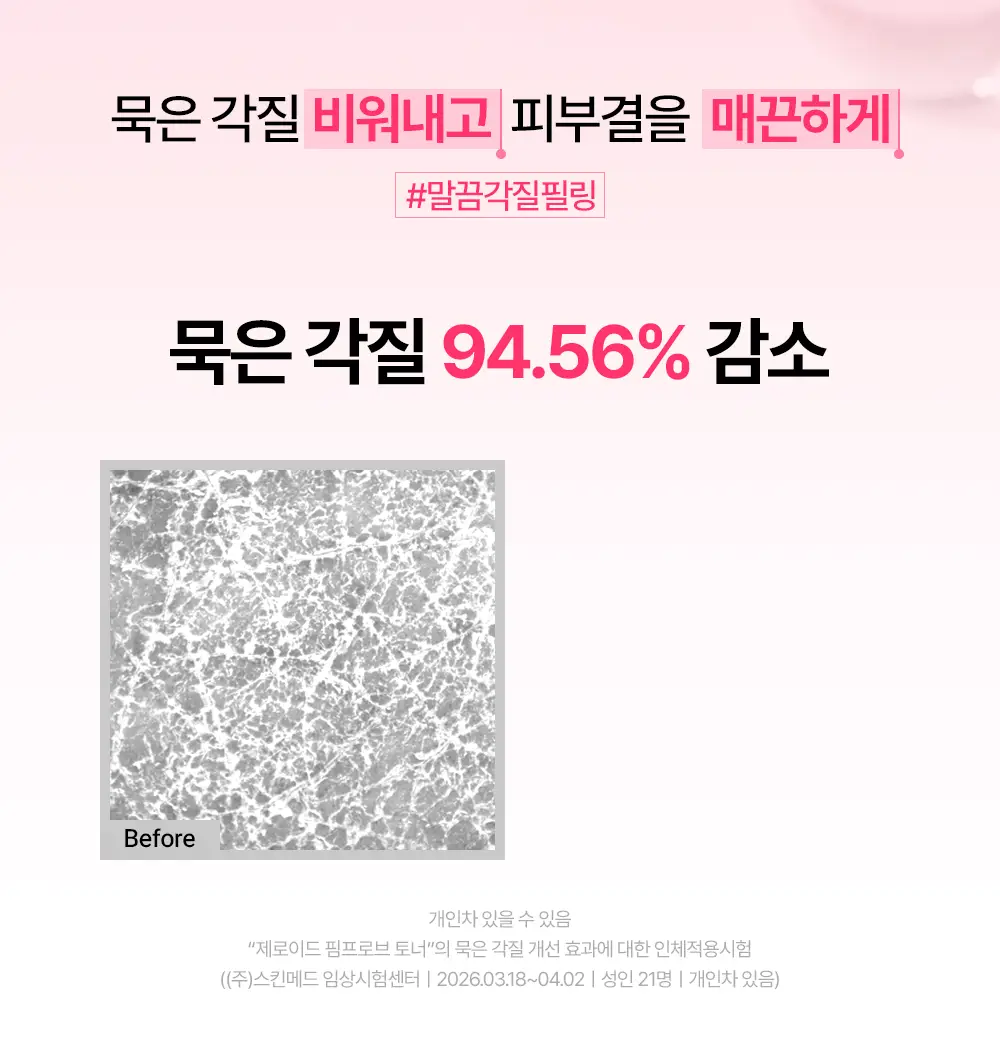 [트러블 피부 추천/저자극 각질 케어] 제로이드 핌프로브 토너 200ml 상세페이지 17